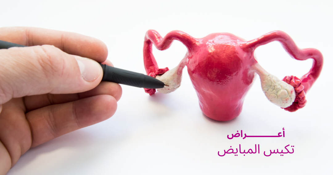 Polycystic ovary syndrome - symptoms and causes